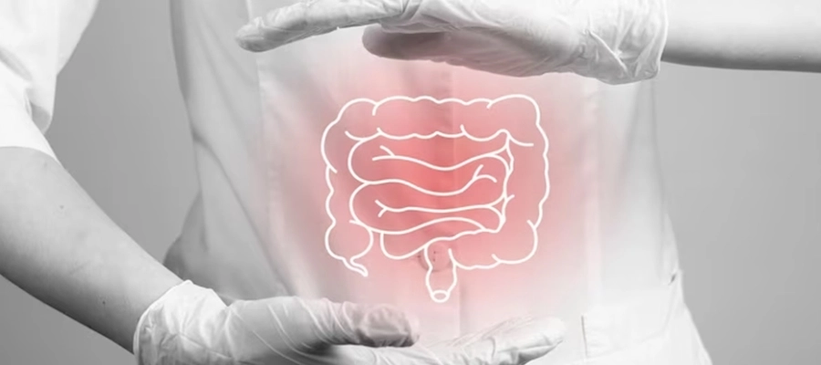 Imagem destaque do post Como aumentar as bactérias boas no intestino? Cuidados essenciais