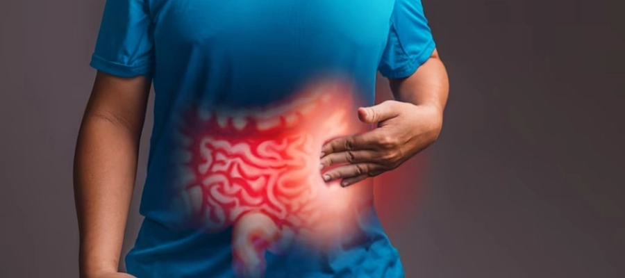 Imagem do Curso de Modulação Gastrointestinal