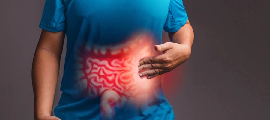 ilustração do intestino e dor na lateral da barriga