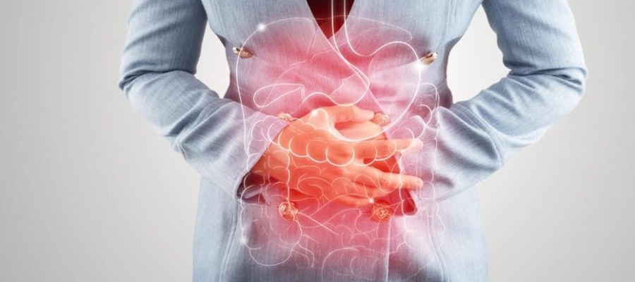 Imagem do post Síndrome do Intestino Irritável: o que é, sintomas e tratamento 